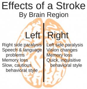 Know Your Stroke Risk – and Why You Need to Act F.A.S.T. | MyInjuryAttorney